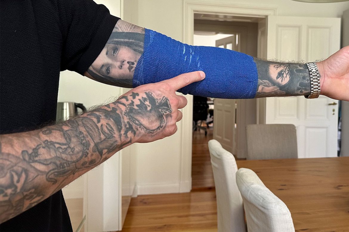 Was tun gegen einen Golferarm 8 Golferarm mit kälte Verband ruhig gestellt