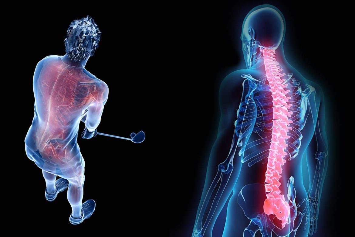 Golf gesund oder ungesund